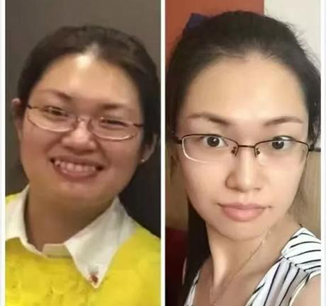 连锁减肥加盟店